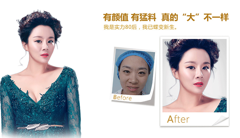 荆门脂肪移植、隆鼻