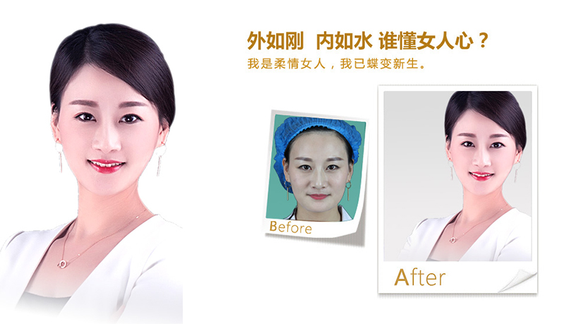 荆门V脸、线雕隆鼻